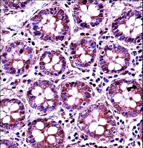 RANGAP1 Antibody immunohistochemistry of formalin-fixed and paraffin-embedded human colon tissue followed by peroxidase-conjugated secondary antibody and DAB staining.
