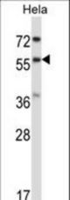 RANGAP1 Antibody western blot of HeLa cell line lysates (35 ug/lane). The RANGAP1 antibody detected the RANGAP1 protein (arrow).