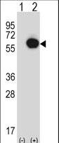 Western blot of RANGAP1 (arrow) using rabbit polyclonal RANGAP1 Antibody. 293 cell lysates (2 ug/lane) either nontransfected (Lane 1) or transiently transfected (Lane 2) with the RANGAP1 gene.