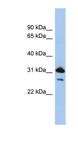 RAP1B antibody LS-C111835 Western blot of PANC1 cell lysate.
