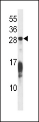 RAP1B Antibody western blot of HeLa cell line lysates (35 ug/lane). The RAP1B antibody detected the RAP1B protein (arrow).