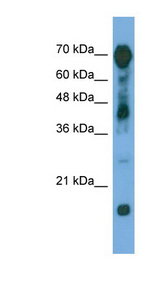 RAP1GAP antibody LS-C117226 Western blot of Transfected 293T cell lysate.