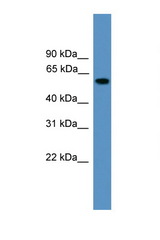 RAP1GDS1 antibody LS-C135575 Western blot of Placenta lysate. Antibody concentration 1 ug/ml.