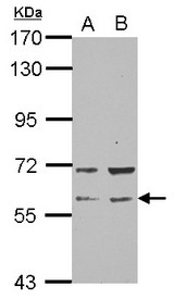 Sample (30 ug of whole cell lysate) A: NT2D1 B: PC-3 7.5% SDS PAGE RAP1GDS1 antibody diluted at 1:1000