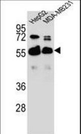 RAP1GDS1 Antibody western blot of HepG2,MDA-MB231 cell line lysates (35 ug/lane). The RAP1GDS1 antibody detected the RAP1GDS1 protein (arrow).