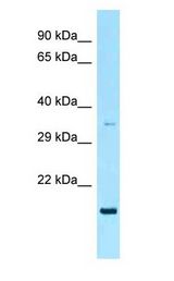 RAP2 antibody Western Blot of MCF7.
