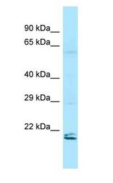 RAP2 antibody Western Blot of HeLa.