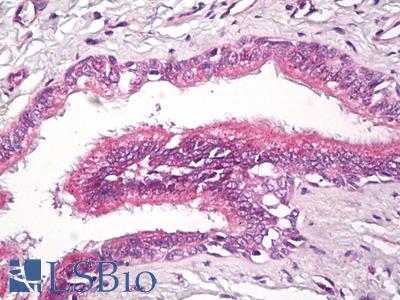 Anti-RAP2 antibody IHC of human lung, respiratory epithelium. Immunohistochemistry of formalin-fixed, paraffin-embedded tissue after heat-induced antigen retrieval. Antibody LS-B7974 dilution 10 ug/ml.