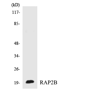 Western blot of the lysates from COLO205 cells using RAP2B antibody.