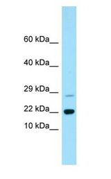 RAP2B antibody Western Blot of Fetal Liver.
