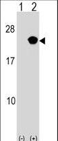 Western blot of RAP2B (arrow) using rabbit polyclonal RAP2B Antibody. 293 cell lysates (2 ug/lane) either nontransfected (Lane 1) or transiently transfected (Lane 2) with the RAP2B gene.