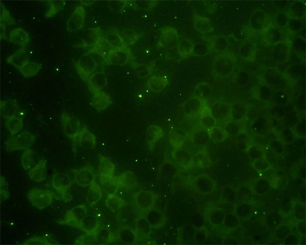 Immunofluorescence of monoclonal antibody to RAP2B on HeLa cell. [antibody concentration 10 ug/ml]