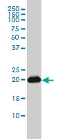 RAP2B monoclonal antibody (M01), clone 4F12-3C6 Western blot of RAP2B expression in A-431.