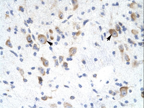 GTF2F2 antibody LS-C30658 was used in IHC to stain formalin-fixed, paraffin-embedded human brain.