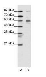 A: Marker, B: K562 Cell Lysate