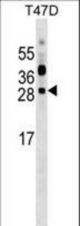 PRTFDC1 Antibody western blot of T47D cell line lysates (35 ug/lane). The PRTFDC1 antibody detected the PRTFDC1 protein (arrow).