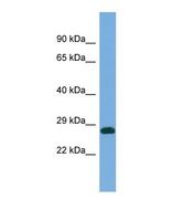 Western blot of Human COLO205. PRUNE antibody dilution 1.0 ug/ml.