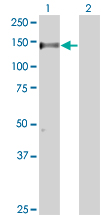 Western Blot analysis of RAPGEF1 expression in transfected 293T cell line by RAPGEF1 monoclonal antibody (M01), clone 3D10.Lane 1: RAPGEF1 transfected lysate(122.7 KDa).Lane 2: Non-transfected lysate.