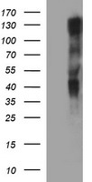 HEK293T cells were transfected with the pCMV6-ENTRY control (Left lane) or pCMV6-ENTRY RAPGEF1 (Right lane) cDNA for 48 hrs and lysed. Equivalent amounts of cell lysates (5 ug per lane) were separated by SDS-PAGE and immunoblotted with anti-RAPGEF1.