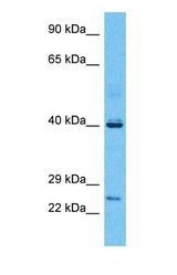 Western blot of PRUNE Antibody with human Fetal Liver lysate.