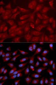 Immunofluorescence analysis of U2OS cell using RAPGEF3 antibody. Blue: DAPI for nuclear staining.