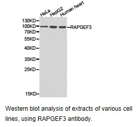 Western blot.