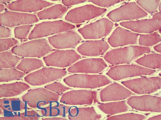 Anti-RAPGEF3 / EPAC antibody IHC staining of human skeletal muscle. Immunohistochemistry of formalin-fixed, paraffin-embedded tissue after heat-induced antigen retrieval. Antibody LS-B9589 concentration 5 ug/ml.