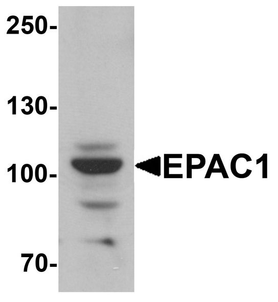 Western blot analysis of EPAC1 in rat skeletal muscle tissue lysate with EPAC1 antibody at 1 ug/ml.