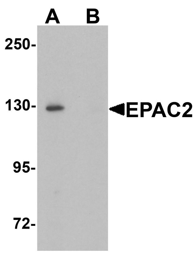 Western blot analysis of EPAC2 in rat liver tissue lysate with EPAC2 antibody at 1 ug/ml in (A) the absence and (B) the presence of blocking peptide.