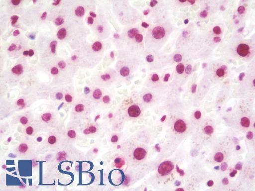 Anti-RAPGEF5 / GFR antibody IHC staining of human liver. Immunohistochemistry of formalin-fixed, paraffin-embedded tissue after heat-induced antigen retrieval. Antibody LS-B10218 dilution 1:50.