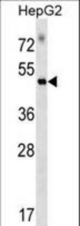 RAPGEF5 Antibody western blot of HepG2 cell line lysates (35 ug/lane). The RAPGEF5 antibody detected the RAPGEF5 protein (arrow).