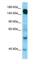 RAPGEF6 antibody Western Blot of Fetal Brain.