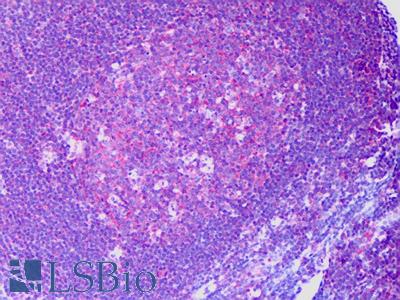 Anti-RAPGEF6 / RAGEF2 antibody IHC of human tonsil, germinal center. Immunohistochemistry of formalin-fixed, paraffin-embedded tissue after heat-induced antigen retrieval. Antibody LS-B6348 concentration 5 ug/ml.
