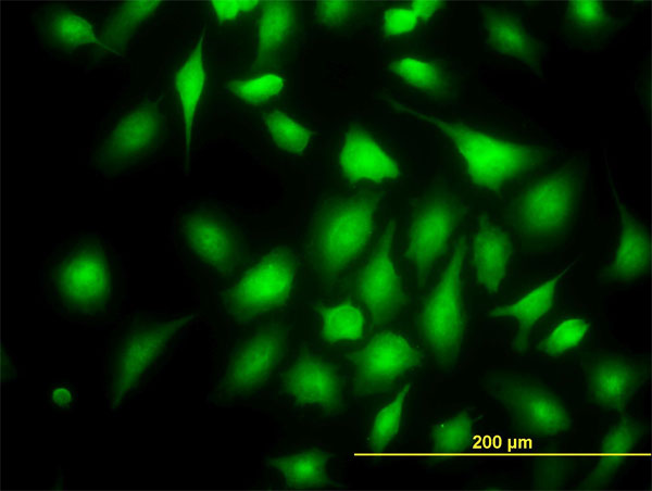 Immunofluorescence of monoclonal antibody to RAPGEF6 on HeLa cell. [antibody concentration 40 ug/ml]