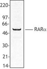 MOLT-4 nuclear extract was resolved by electrophoresis, transferred to nitrocellulose, and probed with rabbit anti-RARalpha antibody. Proteins were visualized using a donkey anti-rabbit secondary conjugated to HRP and a chemiluminescence detection system.