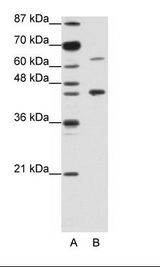 A: Marker, B: Jurkat Cell Lysate