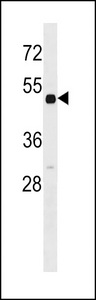 RARB Antibody western blot of mouse heart tissue lysates (35 ug/lane). The RARB antibody detected the RARB protein (arrow).