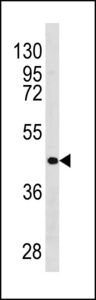 RARB Antibody western blot of 293 cell line lysates (35 ug/lane). The RARB antibody detected the RARB protein (arrow).