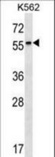 RARB Antibody western blot of K562 cell line lysates (35 ug/lane). The RARB antibody detected the RARB protein (arrow).