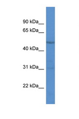 RARG antibody LS-C134986 Western blot of 3 Cell lysate. Antibody concentration 1 ug/ml.