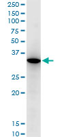 RARRES1 monoclonal antibody (M06), clone 2E2. Western blot of RARRES1 expression in HL-60.