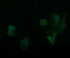 Anti-RARRES1 mouse monoclonal antibody immunofluorescent staining of COS7 cells transiently transfected by pCMV6-ENTRY RARRES1.
