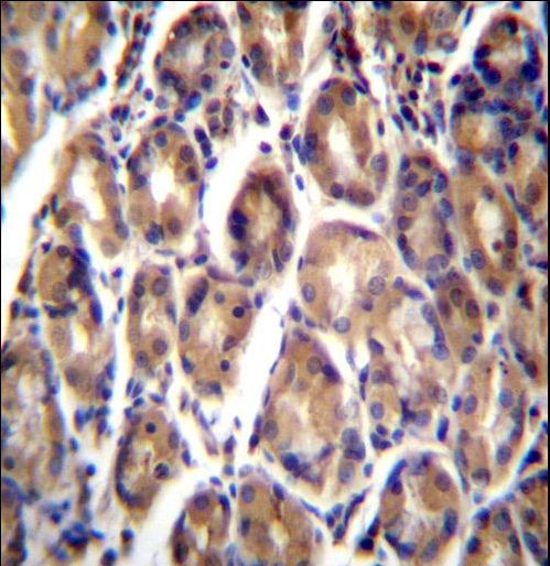 RARRES1 Antibody immunohistochemistry of formalin-fixed and paraffin-embedded human stomach tissue followed by peroxidase-conjugated secondary antibody and DAB staining.