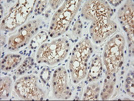 IHC of paraffin-embedded Human Kidney tissue using anti-RARRES1 mouse monoclonal antibody.