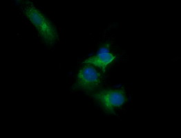 Anti-RARRES1 mouse monoclonal antibody immunofluorescent staining of COS7 cells transiently transfected by pCMV6-ENTRY RARRES1.