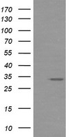 HEK293T cells were transfected with the pCMV6-ENTRY control (Left lane) or pCMV6-ENTRY RARRES1 (Right lane) cDNA for 48 hrs and lysed. Equivalent amounts of cell lysates (5 ug per lane) were separated by SDS-PAGE and immunoblotted with anti-RARRES1.