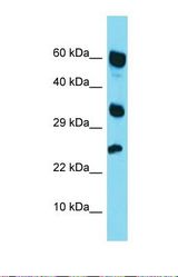 Western blot of Human HepG2. RARRES1 antibody dilution 1.0 ug/ml.