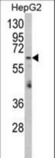 Western blot of RARS2 Antibody in HepG2 cell line lysates (35 ug/lane). RARS2 (arrow) was detected using the purified antibody.