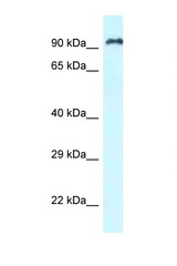 RASAL1 antibody LS-C145743 Western blot of Jurkat Cell lysate. Antibody concentration 1 ug/ml.
