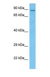Western blot of RASAL1 Antibody with human MCF7 Whole Cell lysate.
